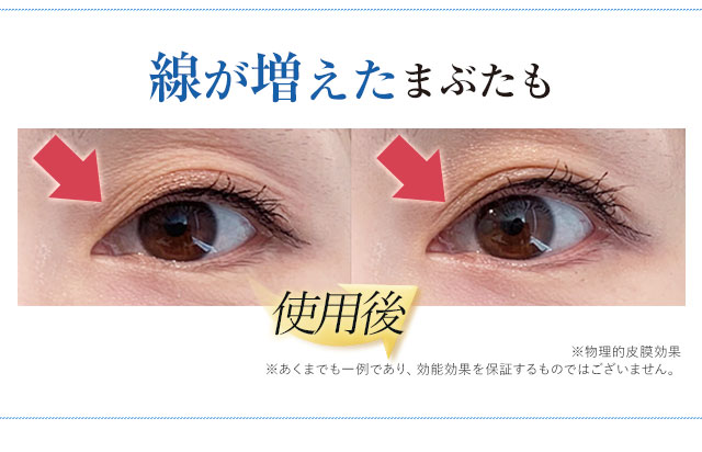 公式】『リッドキララ』まぶたには、まぶたの最終手段