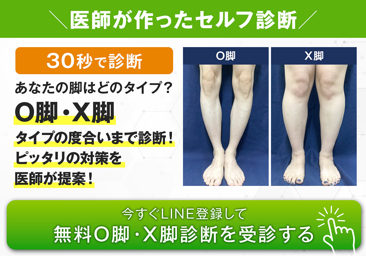 初めてO脚・X脚治療プログラムを受ける方へ-痛みの原因治療専門外来