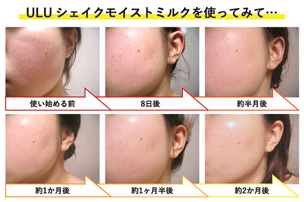 ウルウフリー シェイクモイストミルク本品30％OFF＋プレゼント！赤ら顔